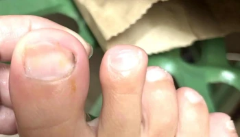 Azilda Family Foot Care - Azilda