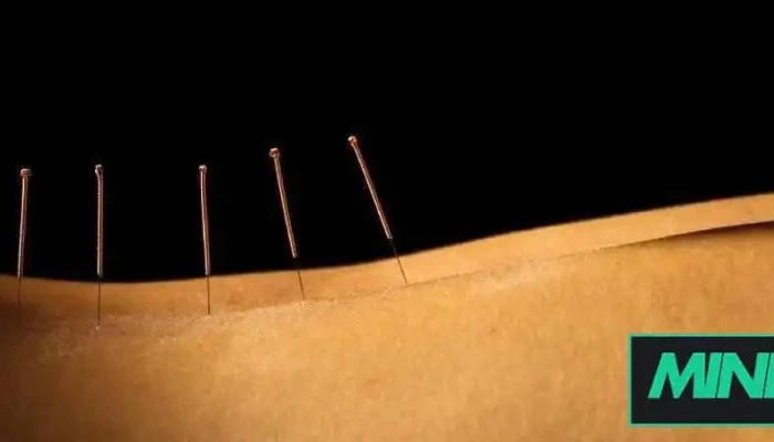 Acupuncture Louise Robinson - Ormstown