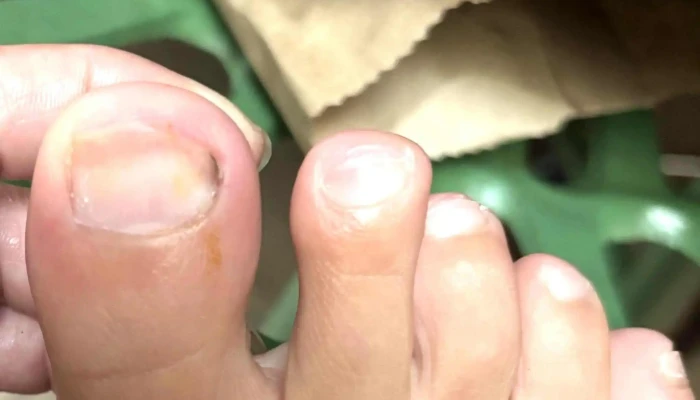 Azilda Family Foot Care - Azilda